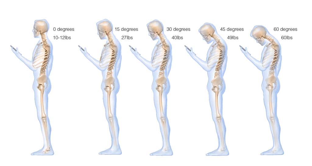 Degrees of posture